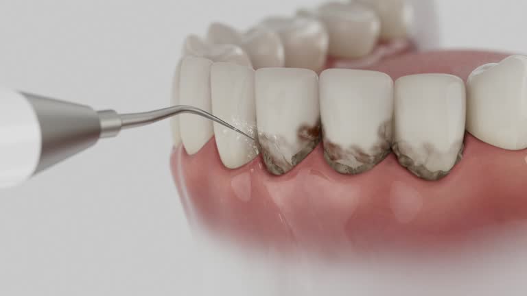 Reliable Teeth Cleaning And Checkup contractor in Wythe County County, VA by Dentist Open Now